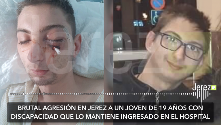 Jerez TV agresión joven discapacitado en Jerez 2022